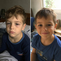Two photos of the same boy: tired with dark circles under his eyes in bed, then smiling and alert.